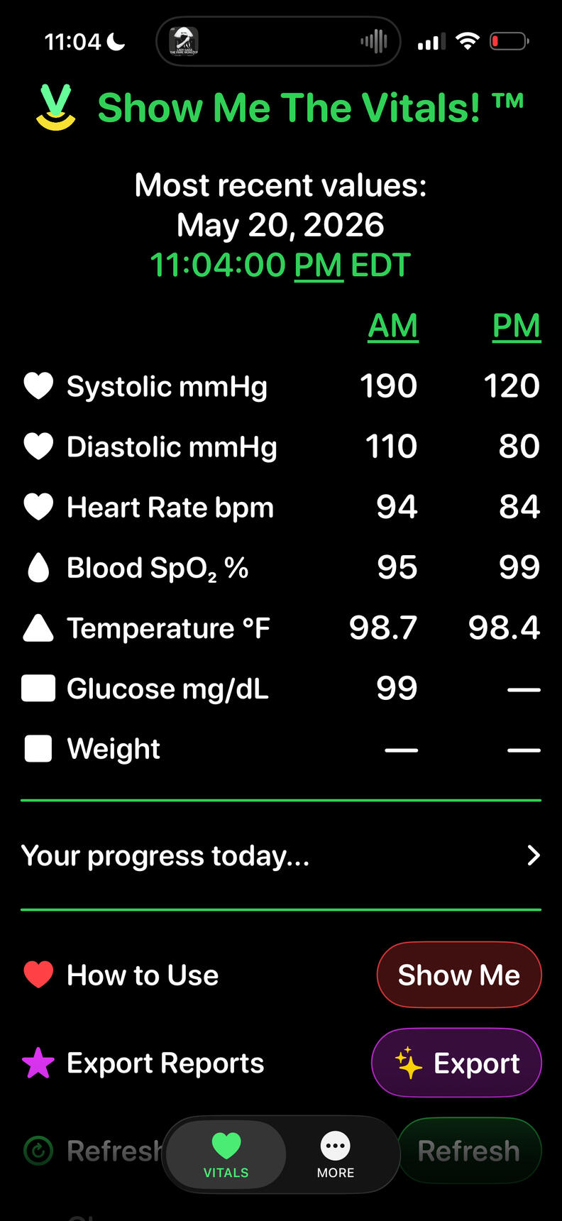Show Me The Vitals app screen in day mode showing today’s AM and PM vital-sign stacks.